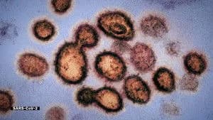 Coronavirus, Explained 1. Sezon 1. Bölüm